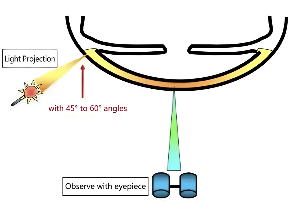 slit-lamp-cases-feature