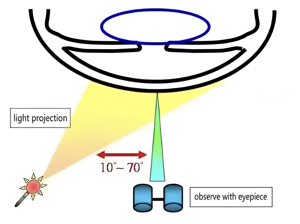 slit-lamp-cases-feature