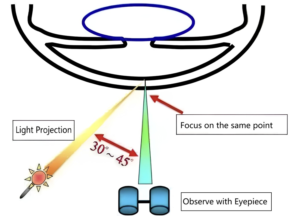 Slit-Lamp-Illumination-Techniques-and-Veterinary-Ophthalmology-Cases_Direct-Focal-Illumination