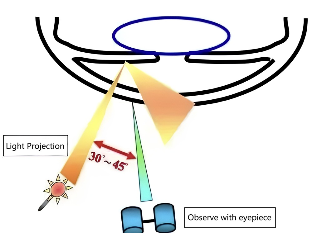 slit-lamp-cases-feature