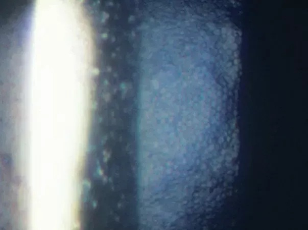 slit-lamp-cases-feature