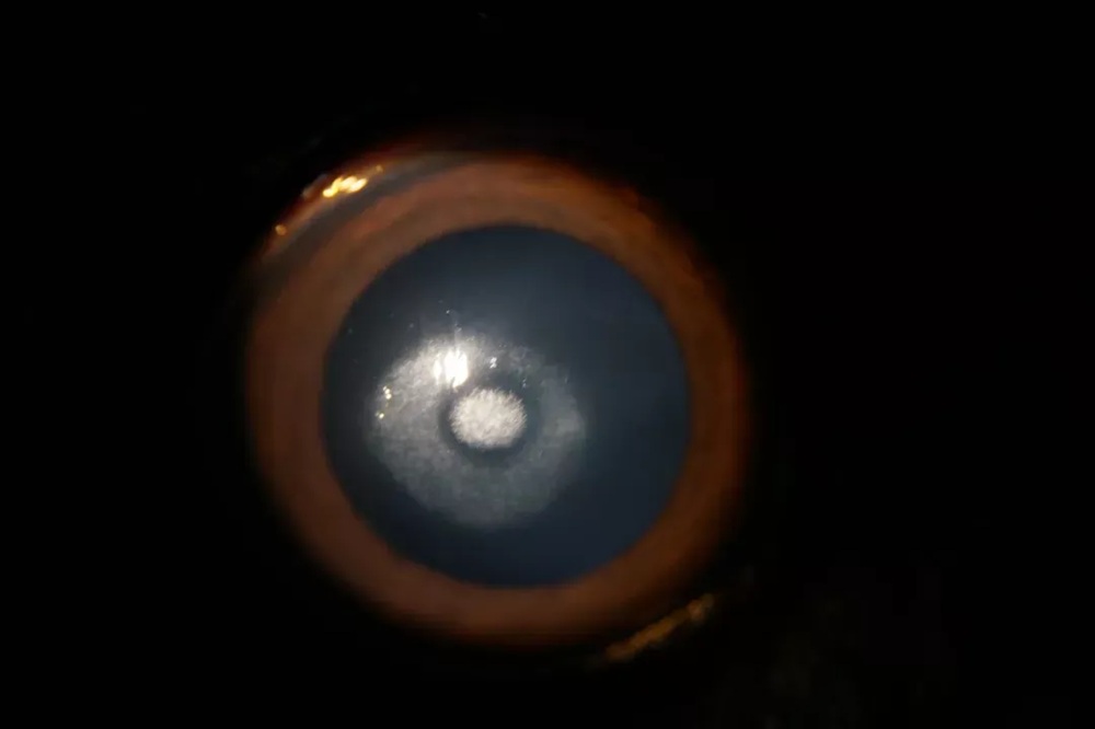 slit-lamp-cases-img