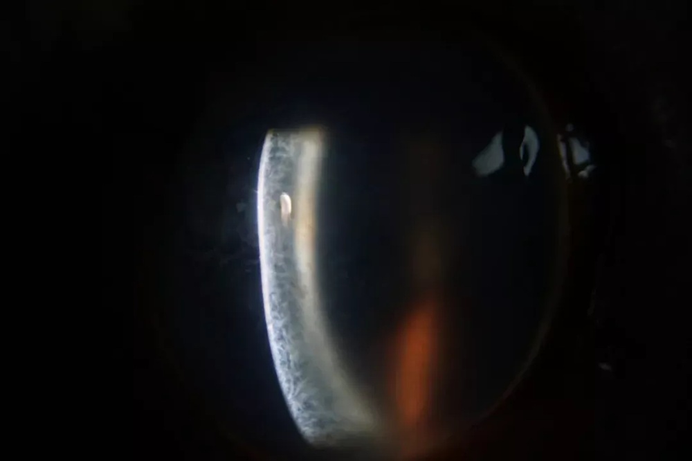 slit-lamp-cases-feature
