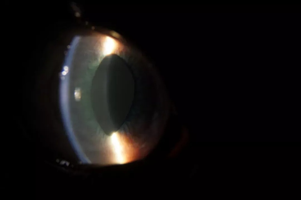 Slit-Lamp-Illumination-Techniques-and-Veterinary-Ophthalmology-Cases_Indirect-Illumination
