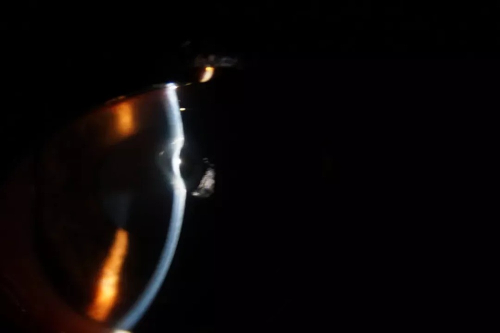 Slit-Lamp-Illumination-Techniques-and-Veterinary-Ophthalmology-Cases_Indirect-Illumination