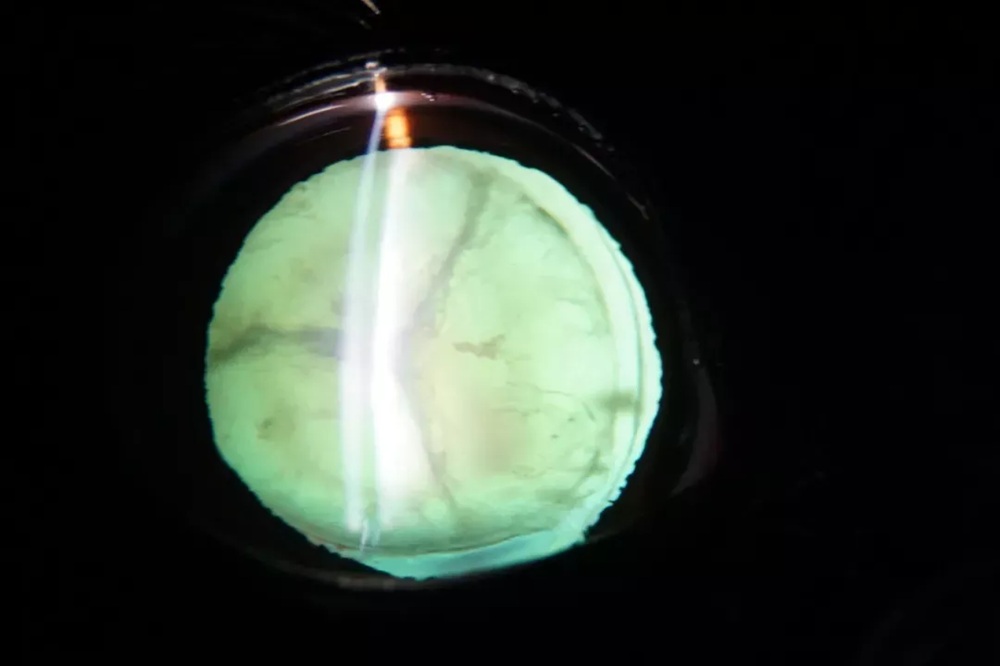 slit-lamp-cases-feature