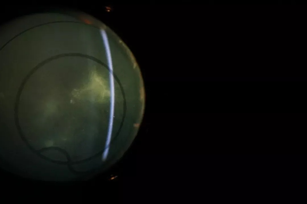 slit-lamp-cases-feature