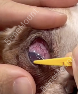 Bandage Lens