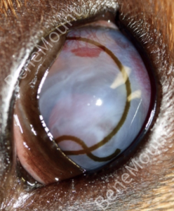 Bandage Lens