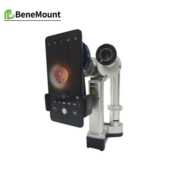 Slit Lamp Function Slit Lamp Common Illumination Techniques and Case Reference