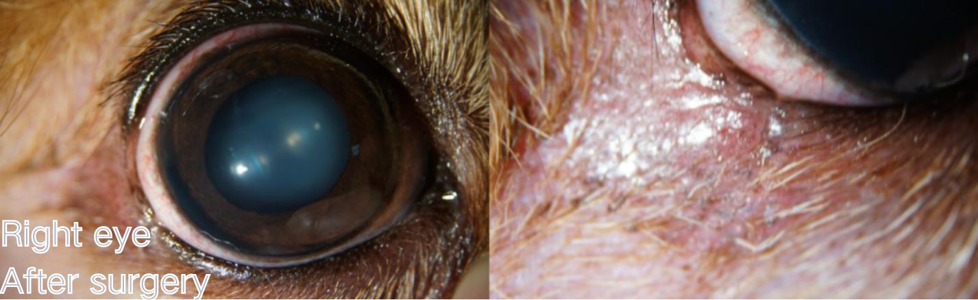 Eyelid Tumors After surgery Right eye