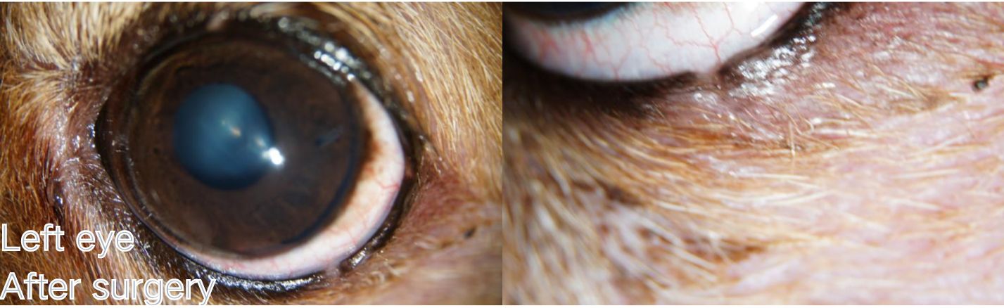 Eyelid Tumors After surgery Left eye