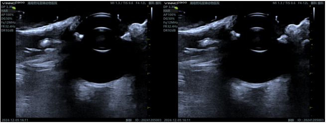 Ocular Ultrasound: