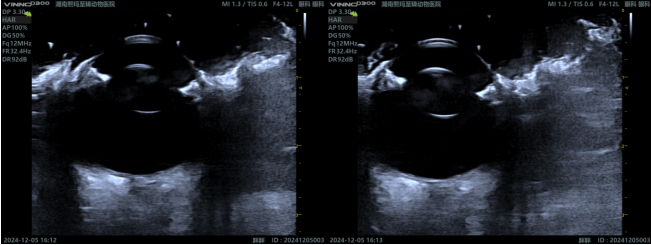 Ocular Ultrasound: