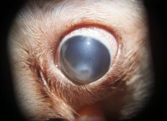 OD Lens dislocation into anterior chamber