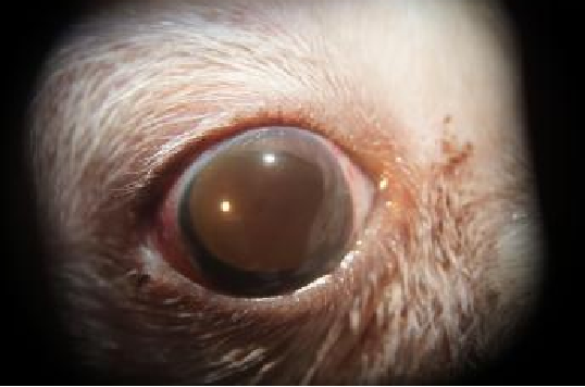 prosthetic eye