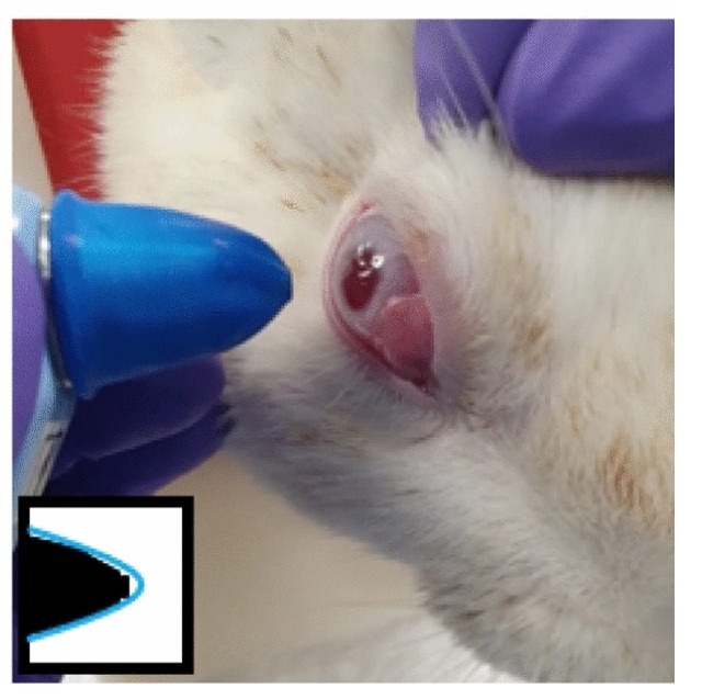 Intraocular Pressure Measurement