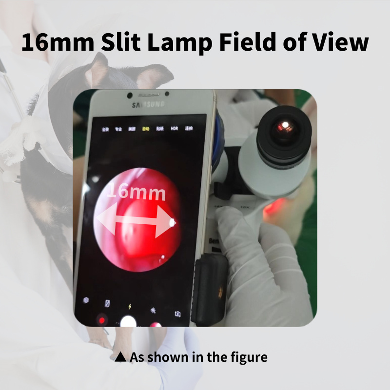 16mm Slit Lamp Field of View