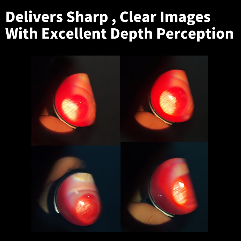 Binocular Indirect Ophthalmoscope