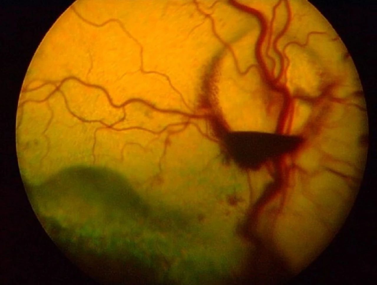 Dog eye systemic hypertension