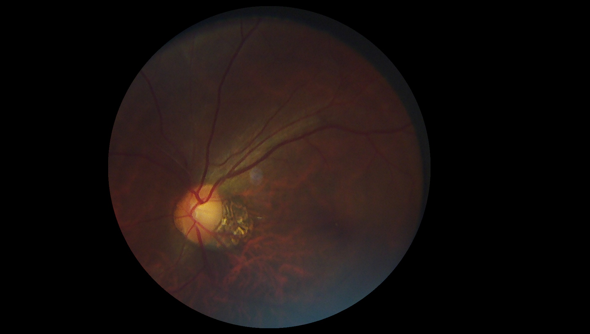 Monkey fundus photo