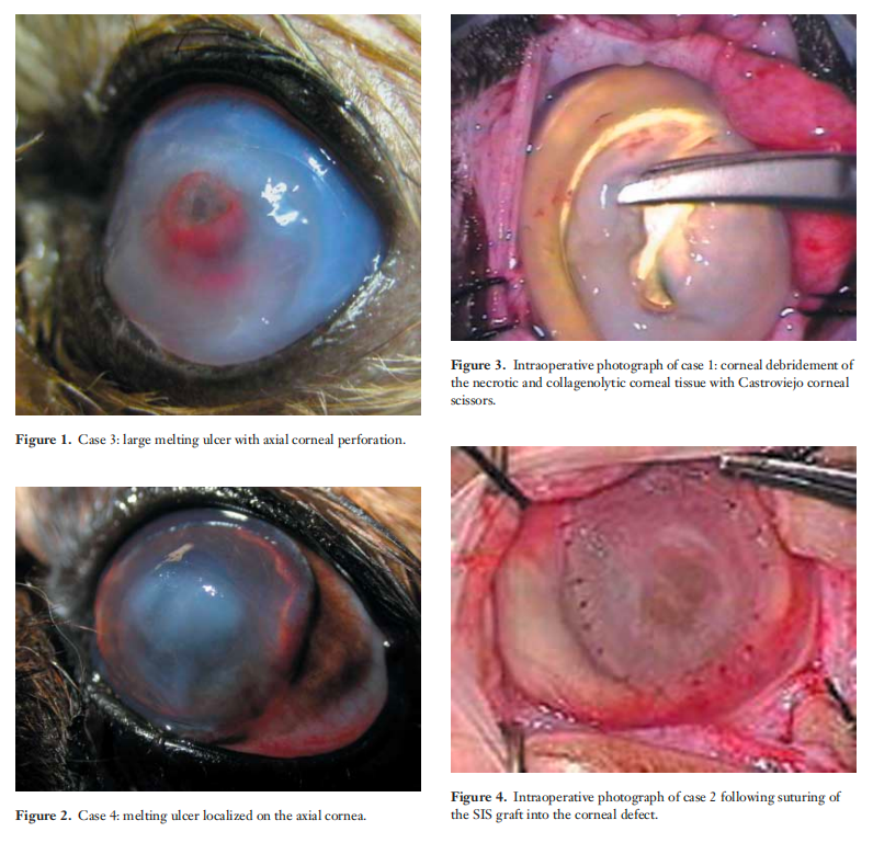 SIS Corneal Ulcer Repair in progress